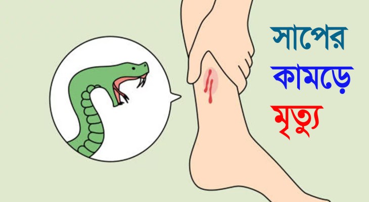 চাঁপাইনবাবগঞ্জে সাপে কেটে কিশোরীর মৃত্যু
