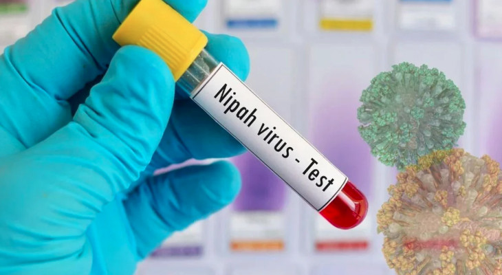 নিপা ভাইরাসে দেশে এ বছরের ‘প্রথম মৃত্যু’