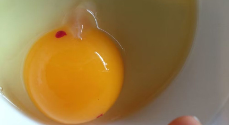 ডিমের কুসুমে রক্তের দাগ, খাওয়া কি নিরাপদ?