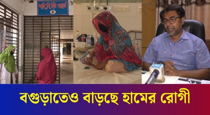 বগুড়ায় বাড়ছে হাম রোগী : ছোটদের পাশাপাশি আক্রান্ত হচ্ছেন বড়রাও