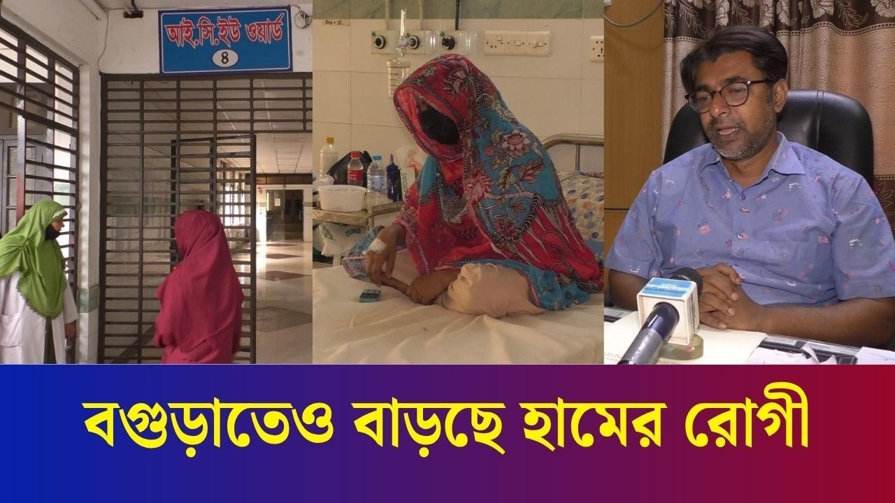 বগুড়ায় বাড়ছে হাম রোগী : ছোটদের পাশাপাশি আক্রান্ত হচ্ছেন বড়রাও
